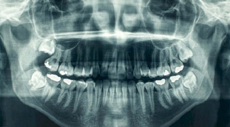 Dental check-ups